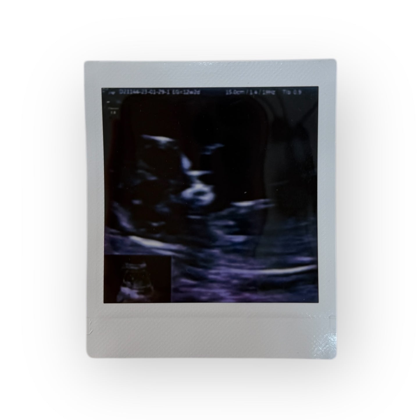 Baby Announcement / Anuncio de embarazo
